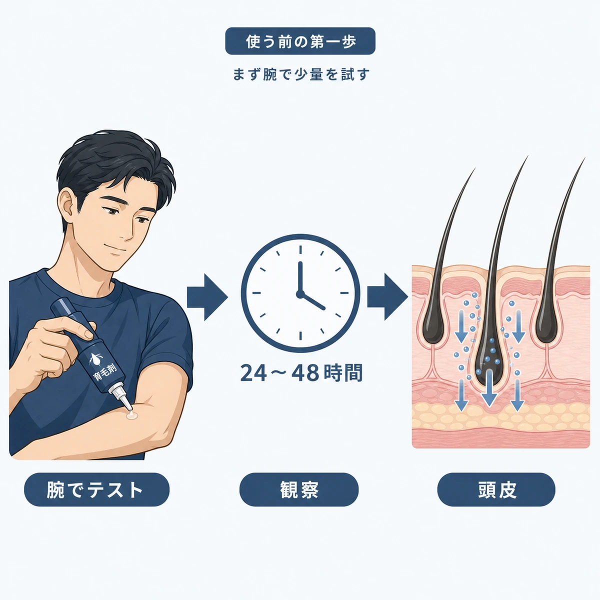 育毛剤を腕に塗って観察し頭皮に使うまでの流れを表した医療イラスト