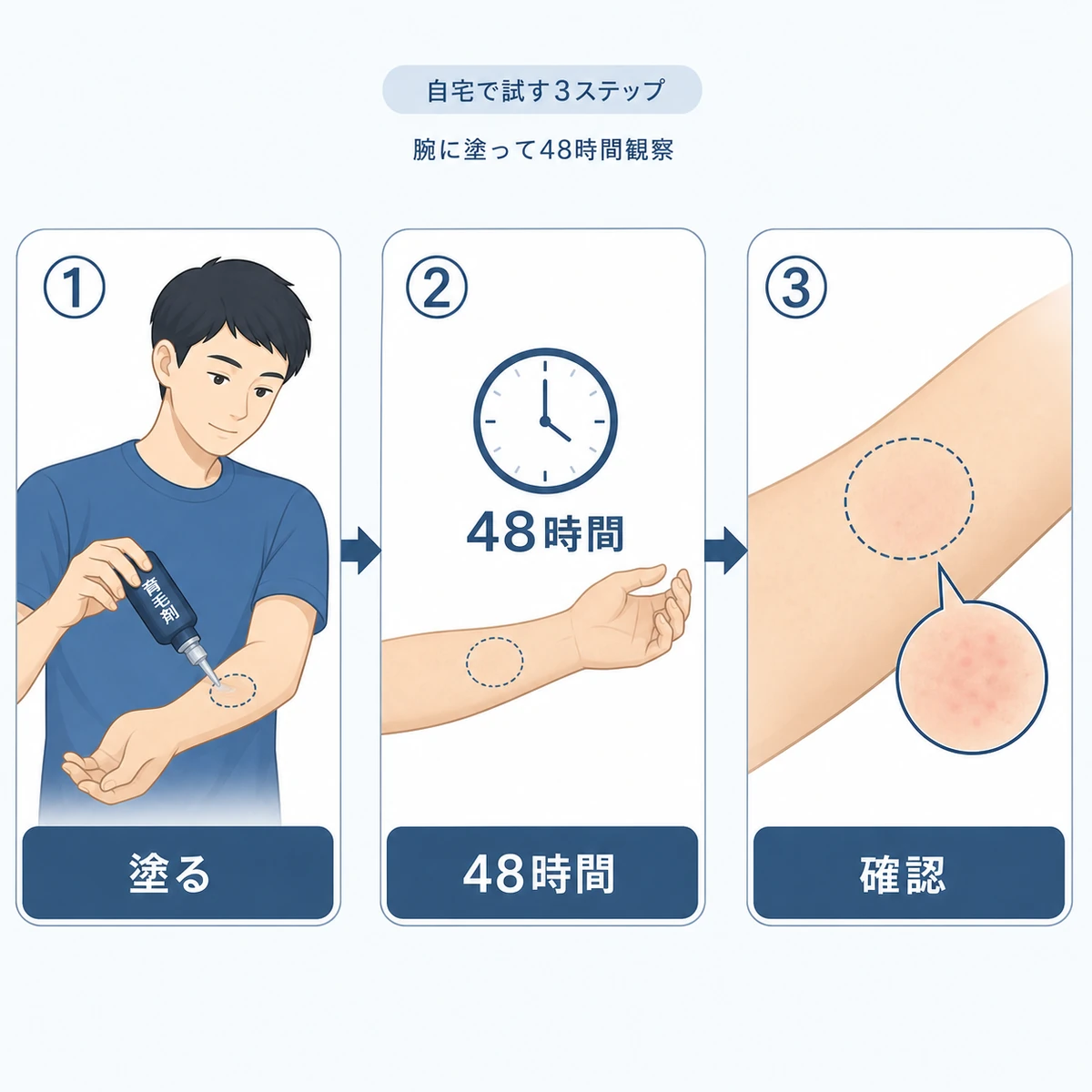 腕に育毛剤を塗り48時間観察して確認するセルフパッチテストの手順を表した医療イラスト
