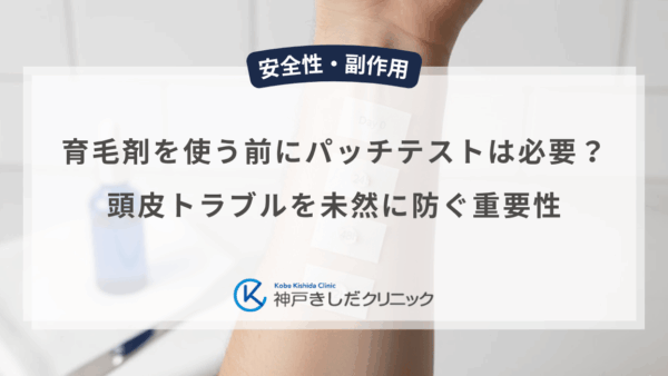 育毛剤を使う前にパッチテストは必要？頭皮トラブルを未然に防ぐ重要性