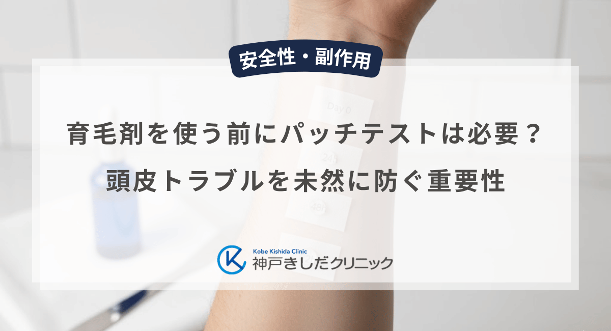 育毛剤を使う前にパッチテストは必要？頭皮トラブルを未然に防ぐ重要性