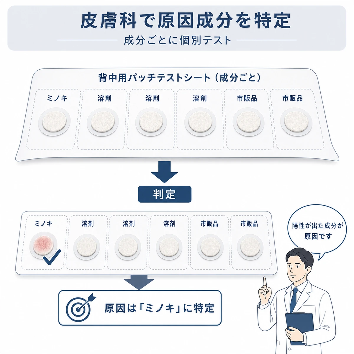皮膚科で成分ごとに個別のパッチテストを行い原因アレルゲンを絞り込む流れを表した医療イラスト