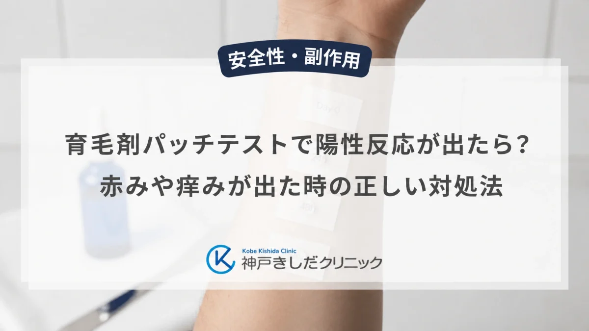 育毛剤パッチテストで陽性反応が出たら？赤みや痒みが出た時の正しい対処法