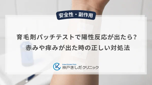育毛剤パッチテストで陽性反応が出たら？赤みや痒みが出た時の正しい対処法
