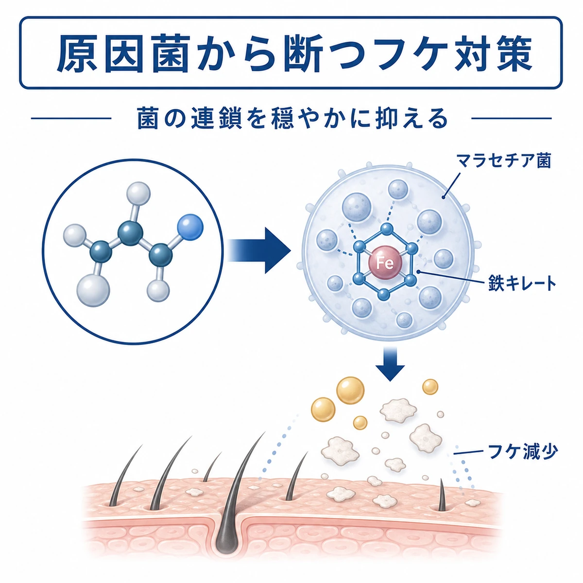 ピロクトンオラミンが原因菌の増殖を抑えフケを減らす仕組みを表した医療イラスト