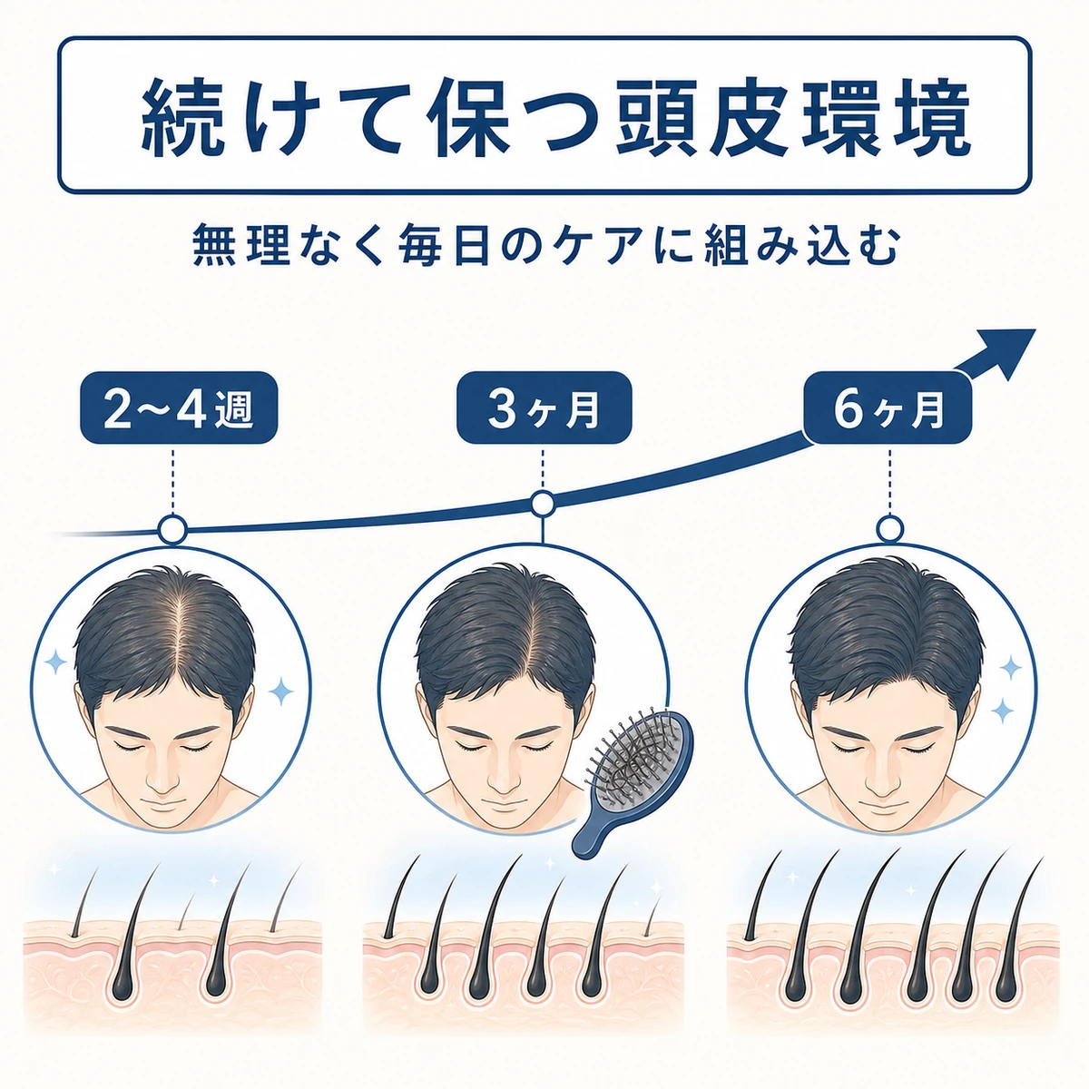 ピロクトンオラミンを続けたときの頭皮環境の変化を期間ごとに表した医療イラスト