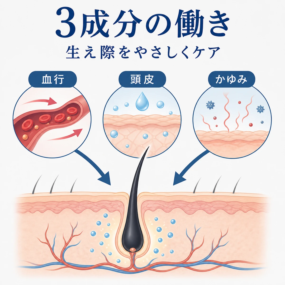 頭皮の断面図に3つの有効成分が血行・頭皮環境・かゆみへ働きかける仕組みを表した医療イラスト