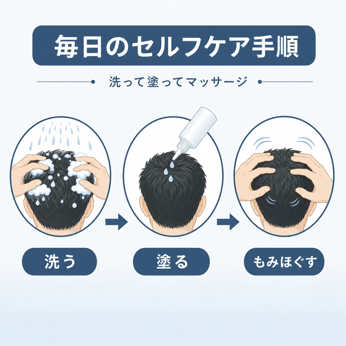 洗浄から塗布とマッサージまで自宅ケアの手順を左から順に表した医療イラスト