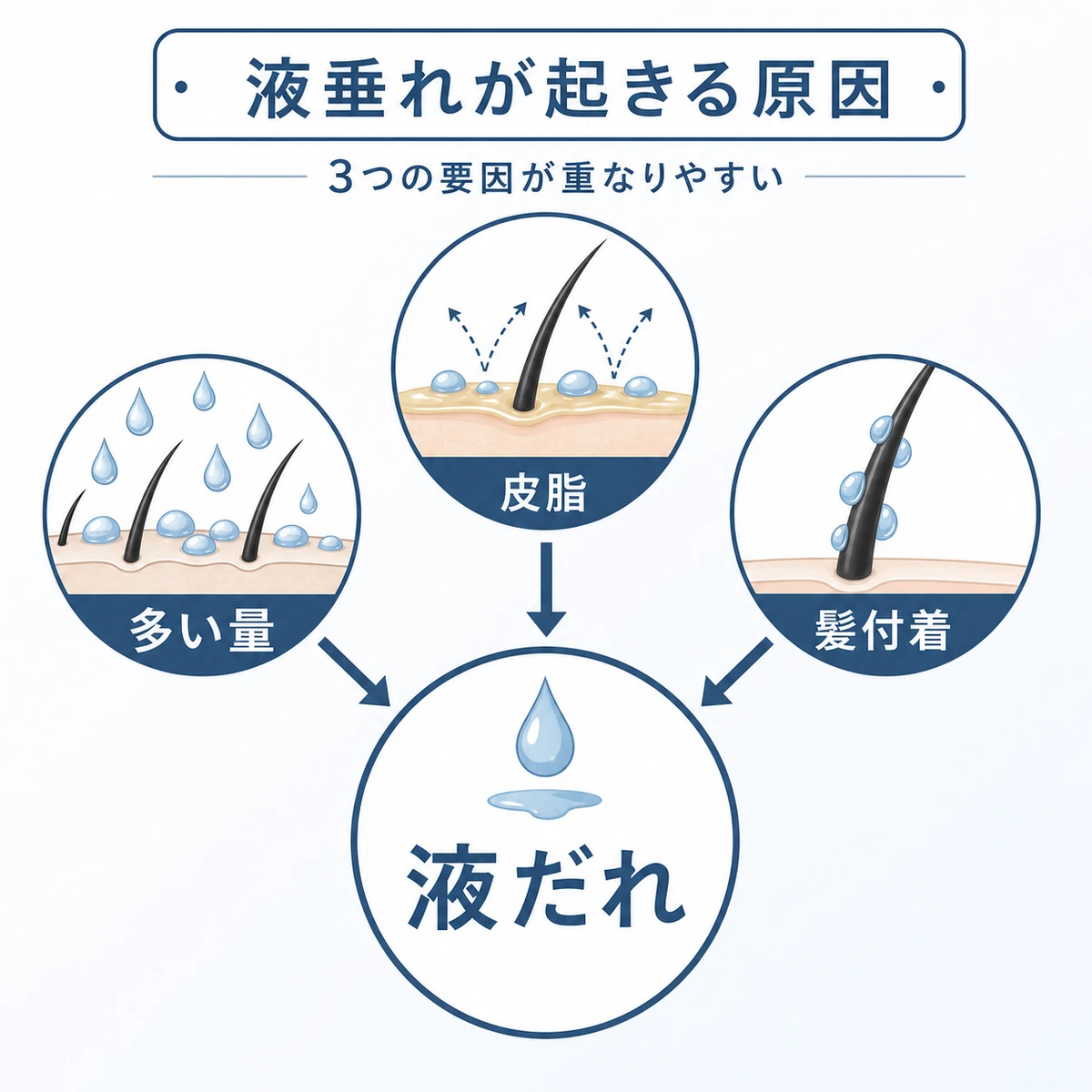 育毛剤が顔に垂れる3つの原因の関係を表した相関図イラスト