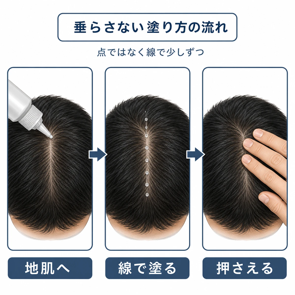 頭皮に線を描くように少量ずつ塗り指で押さえるまでの塗布手順を表した図解イラスト