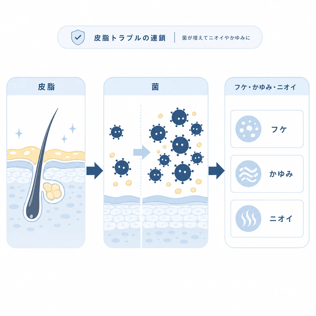 過剰な皮脂を栄養に常在菌が増えフケやかゆみやニオイが起こる流れを表した医療イラスト