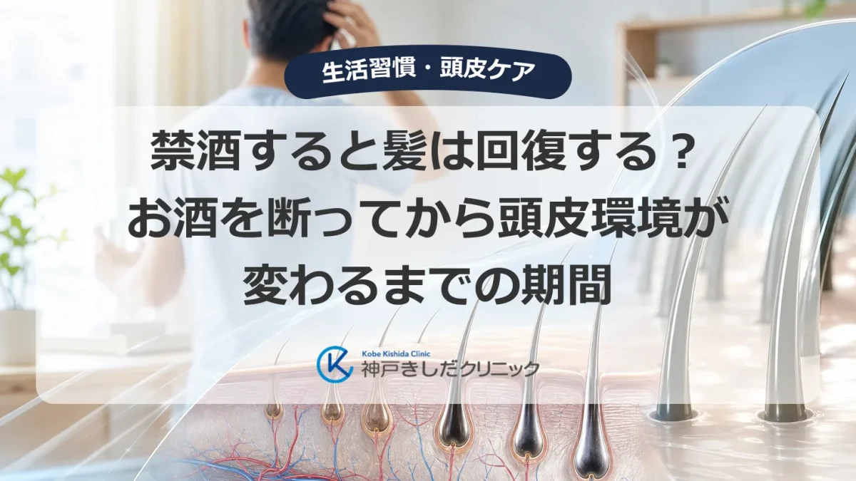 禁酒後に髪の回復を待つ薄毛が気になる男性と頭皮・毛根の医療イメージ