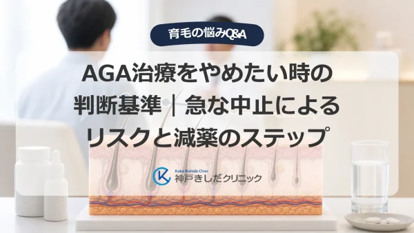 AGA治療をやめたい時の判断基準｜急な中止によるリスクと減薬のステップ