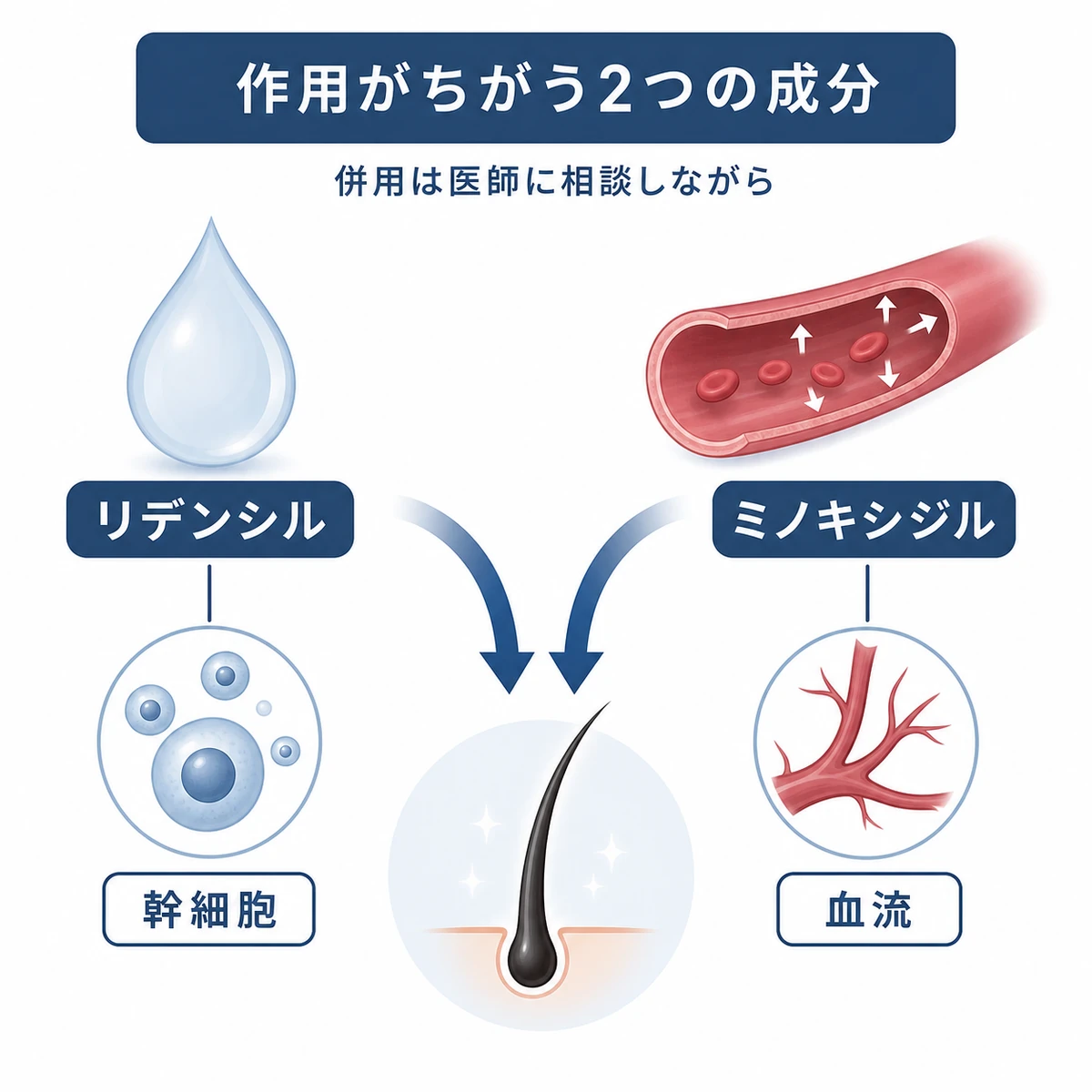 リデンシルとミノキシジルの作用経路の違いと併用の考え方を対比した医療イラスト