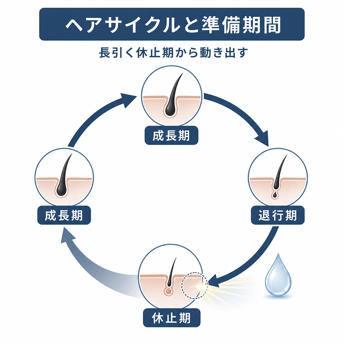 髪の成長期から休止期までのヘアサイクルと長引く休止期が動き出すまでの準備期間を表した医療イラスト