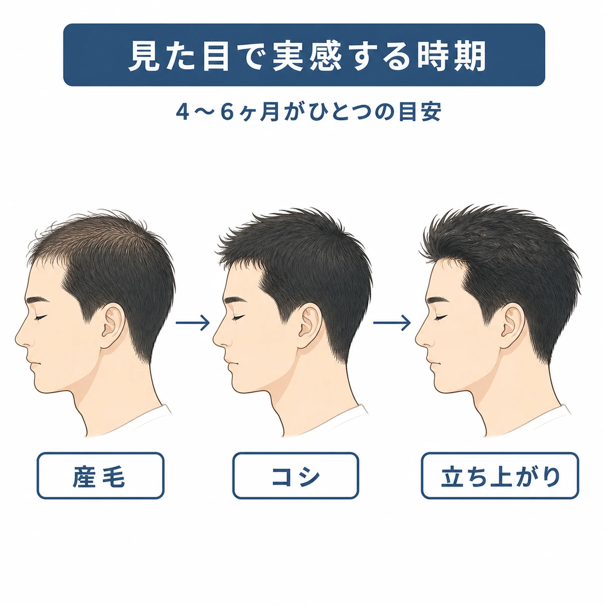 4ヶ月目以降に髪のコシやボリュームが少しずつ変化し見た目で実感できる流れを表した医療イラスト