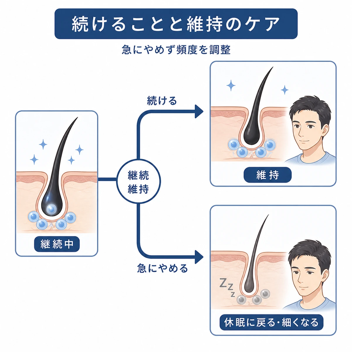 使用を続けた場合と中断した場合で幹細胞の働きが変わる関係と維持ケアの考え方を表した医療イラスト
