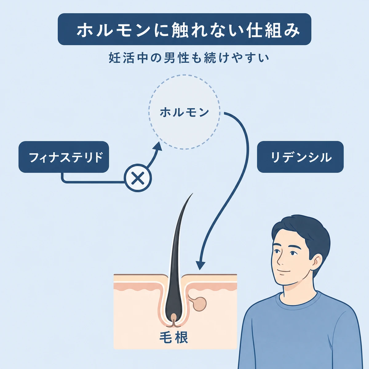リデンシルがホルモン経路に干渉せず毛根に働きかける仕組みを表した医療イラスト