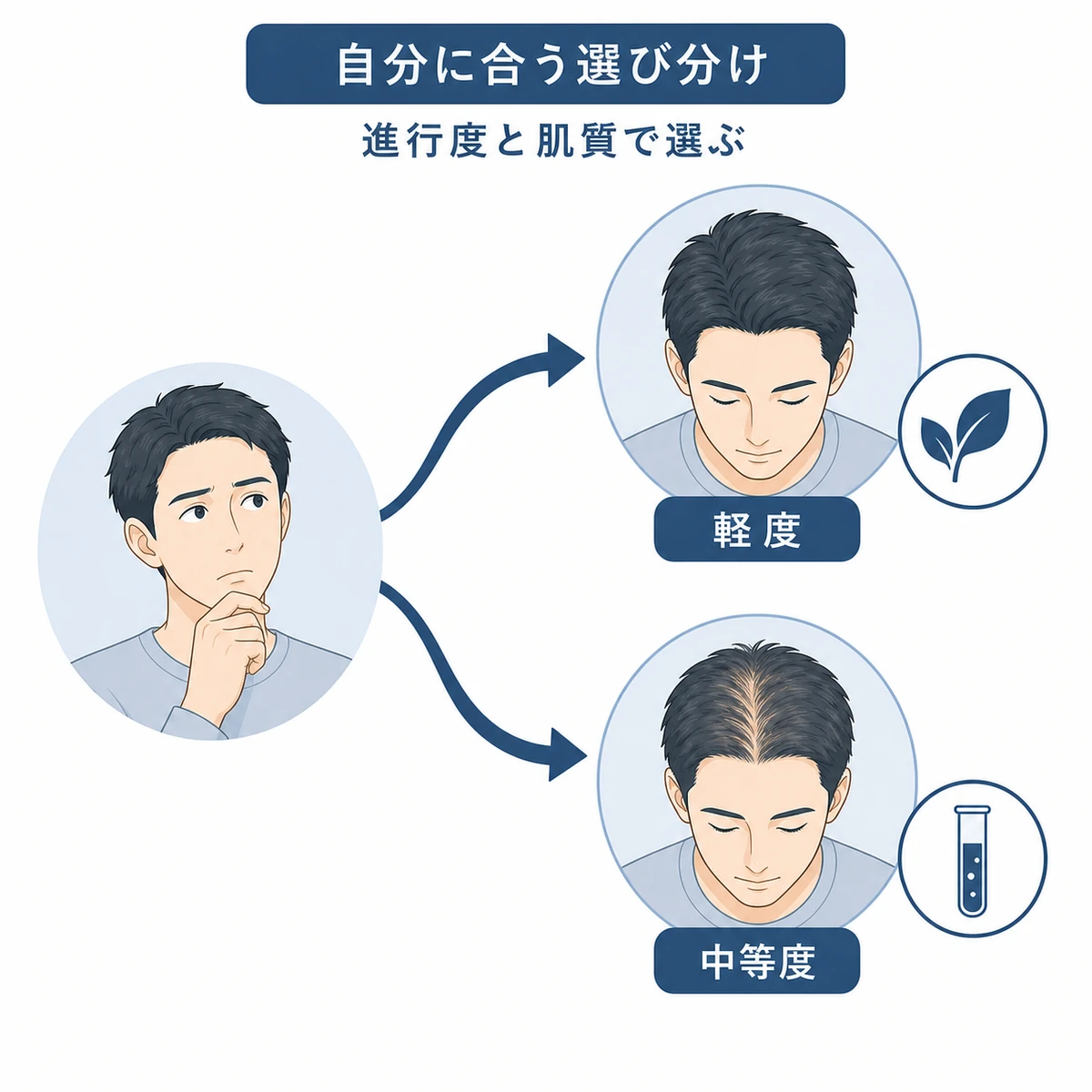 薄毛の進行度に応じて選ぶ成分が分かれる流れを表した医療イラスト