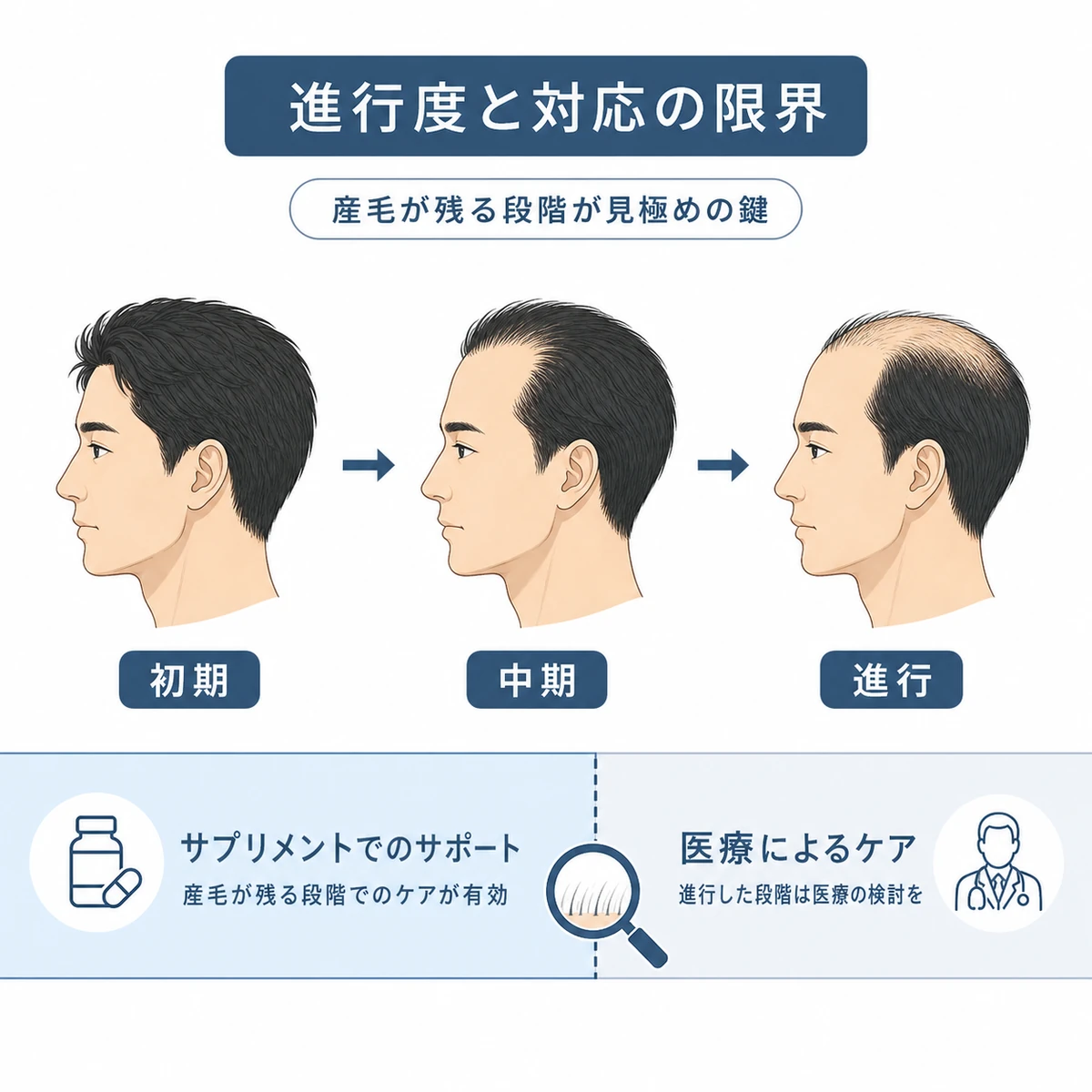 薄毛の進行度とサプリで対応できる範囲の見極めラインを段階で表した医療イラスト