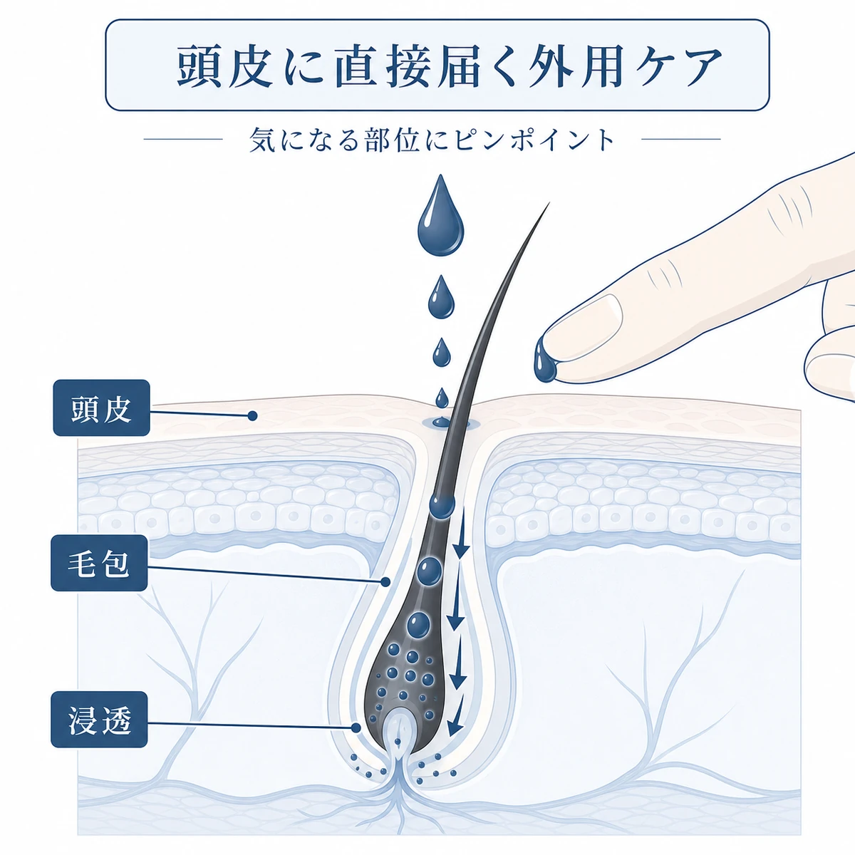 外用ローションが頭皮の毛包に浸透していく断面を表した育毛イラスト