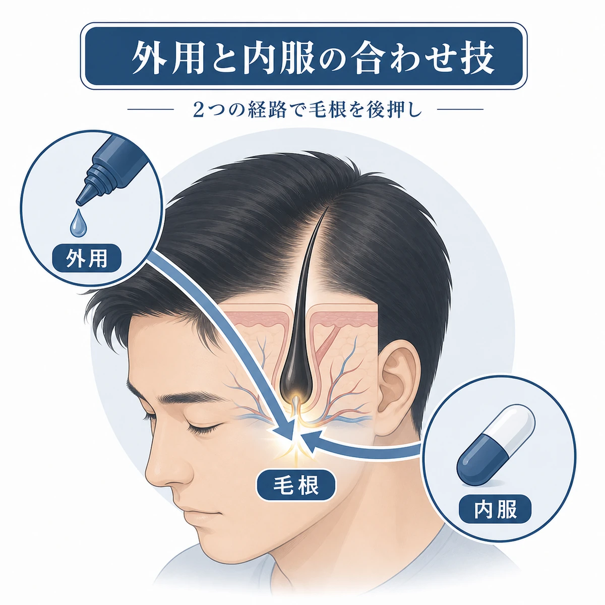 外用と内服の2つの経路が毛根で合流する併用の仕組みを表した育毛イラスト