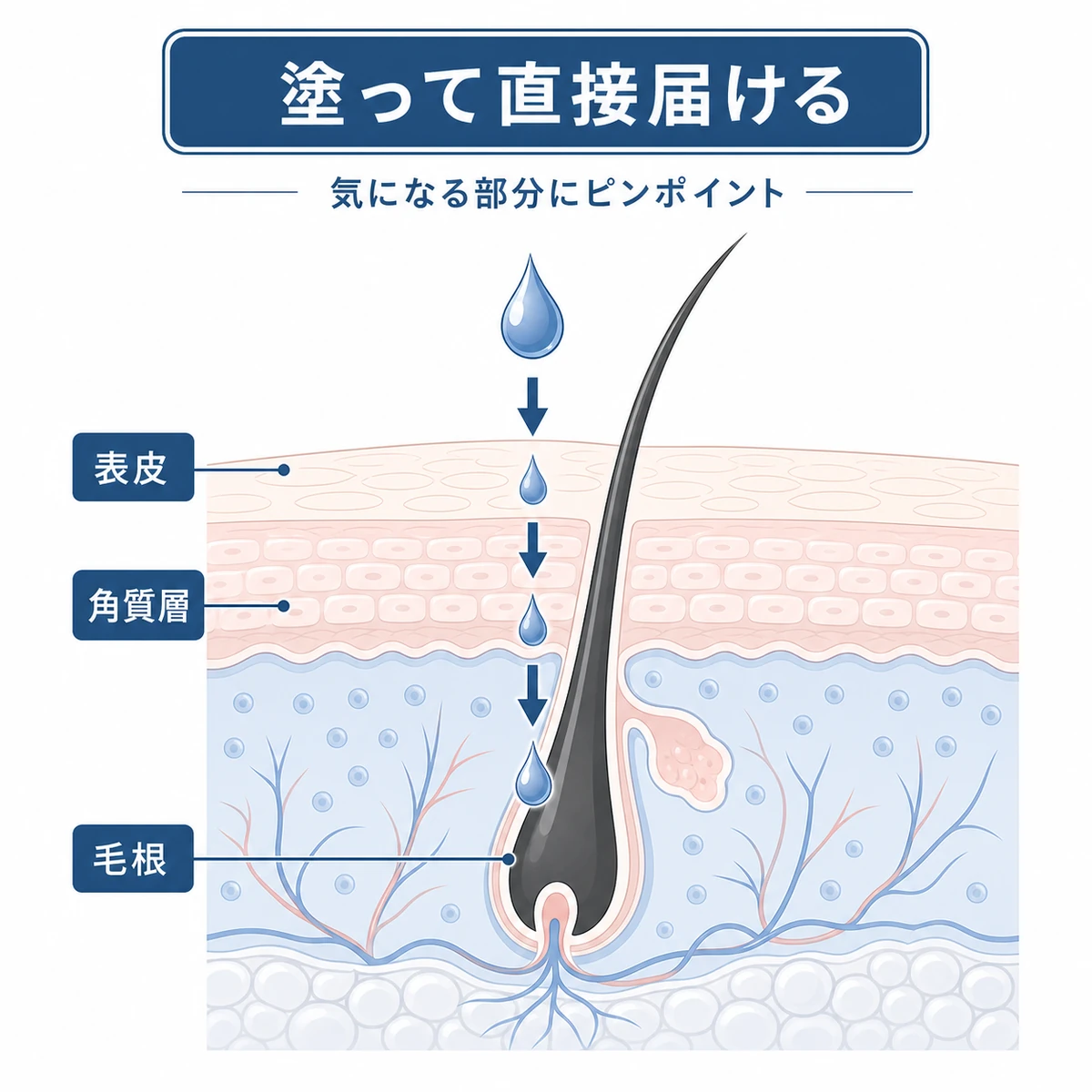 塗る育毛剤の成分が頭皮の断面を通って毛根へ浸透する経路を示した医療イラスト