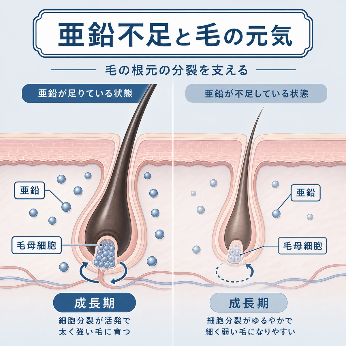 亜鉛不足で毛母細胞の分裂が鈍り抜け毛が増える様子を断面で表した医療イラスト