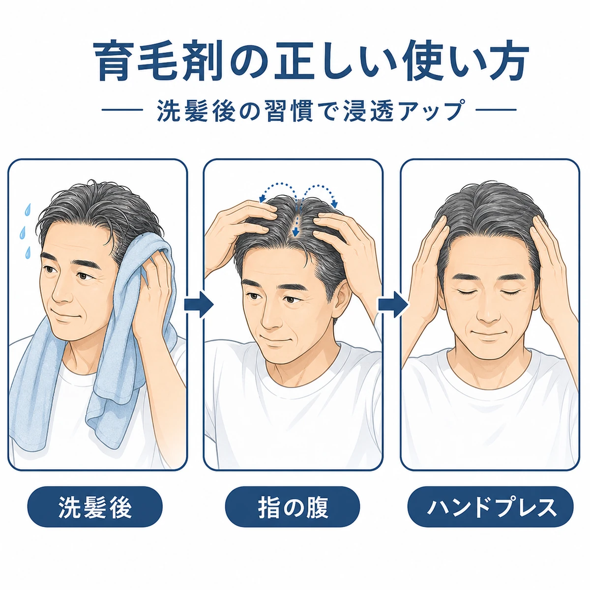 洗髪後にやさしく塗布してハンドプレスでなじませる育毛剤の使い方の流れを表した医療イラスト