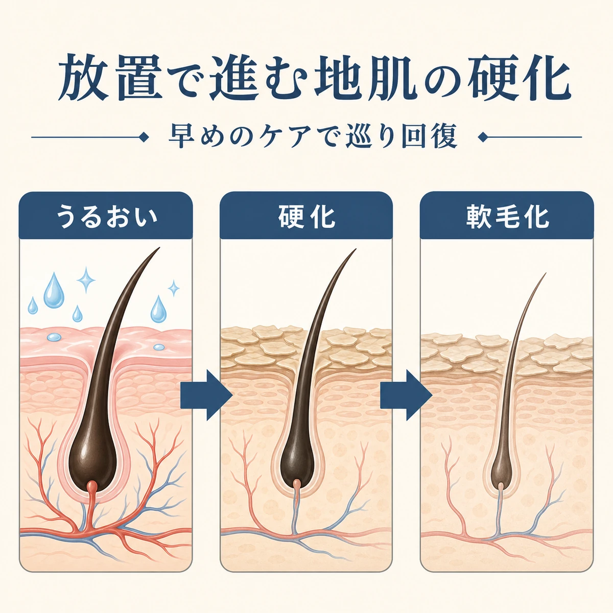 うるおいから乾燥硬化を経て髪が細くなる進行を三段階で示した医療イラスト