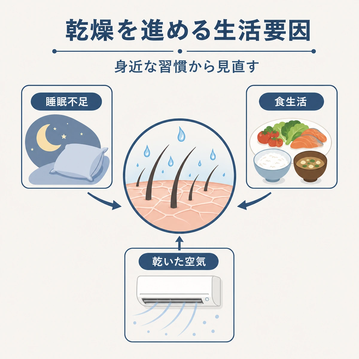 睡眠不足や食生活や乾いた空気が頭皮の乾燥を進める要因を囲み図で示した医療イラスト