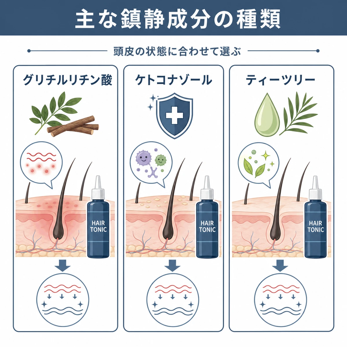 グリチルリチン酸やケトコナゾールなど代表的な頭皮の鎮静成分を並べて比べた医療イラスト