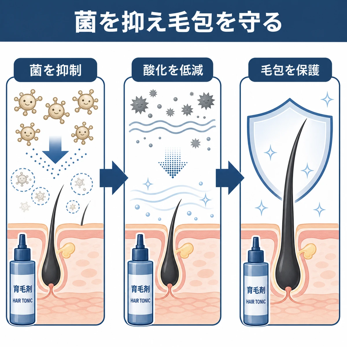 ジンクピリチオンが菌を抑え酸化ストレスを減らし毛包を守るまでの流れを表した医療イラスト