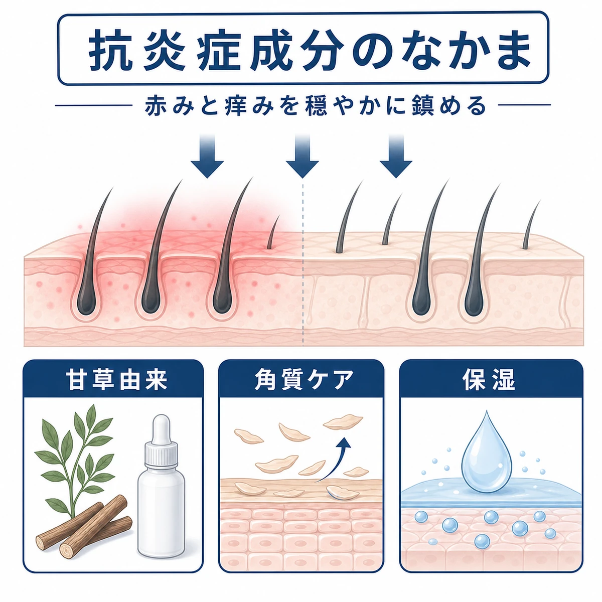 甘草由来成分や保湿成分など頭皮の炎症を穏やかに鎮める抗炎症育毛成分を並べた医療イラスト