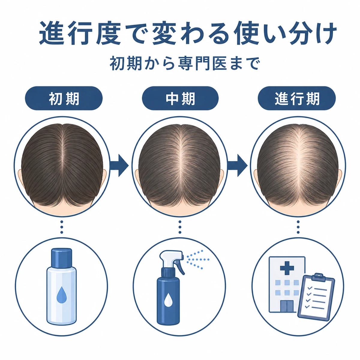 薄毛の進行度に応じたケアの使い分けを初期から進行期まで段階で表した医療イラスト