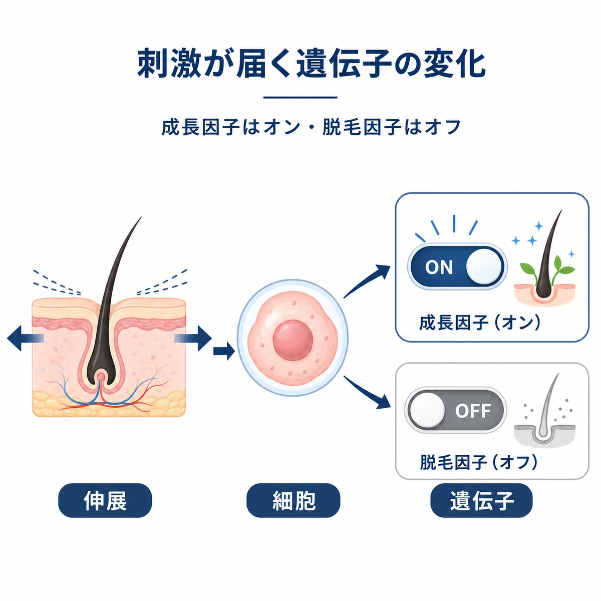 頭皮の伸展刺激が毛乳頭細胞に届き遺伝子の働きが切り替わる流れを表した医療イラスト