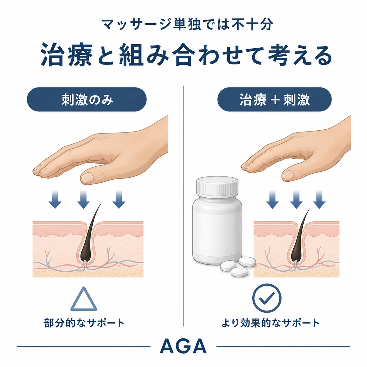 AGA対策でマッサージ単独と薬物治療併用を冷静に対比した医療イラスト