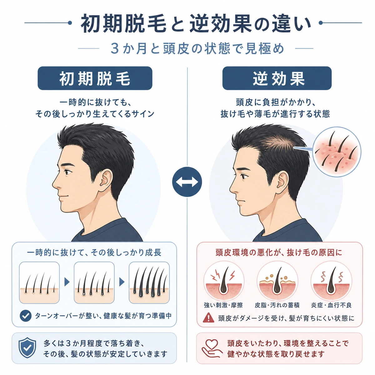 初期脱毛と逆効果による抜け毛の違いを左右で対比した医療イラスト