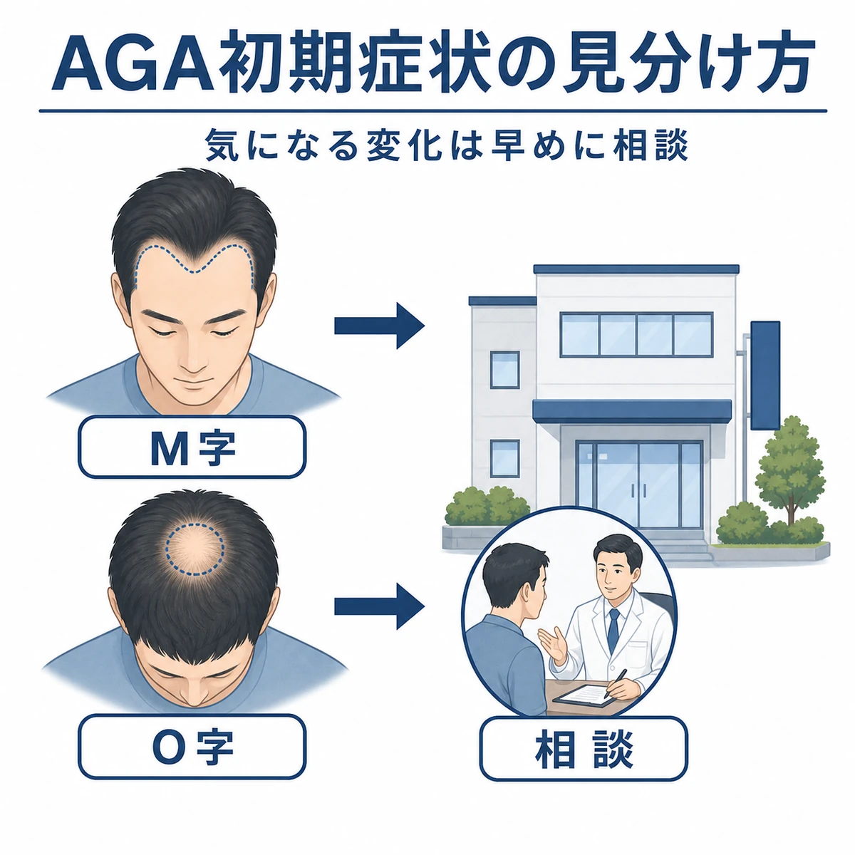 AGAのM字型とO字型の進行パターンを比べて相談へつなげた医療イラスト