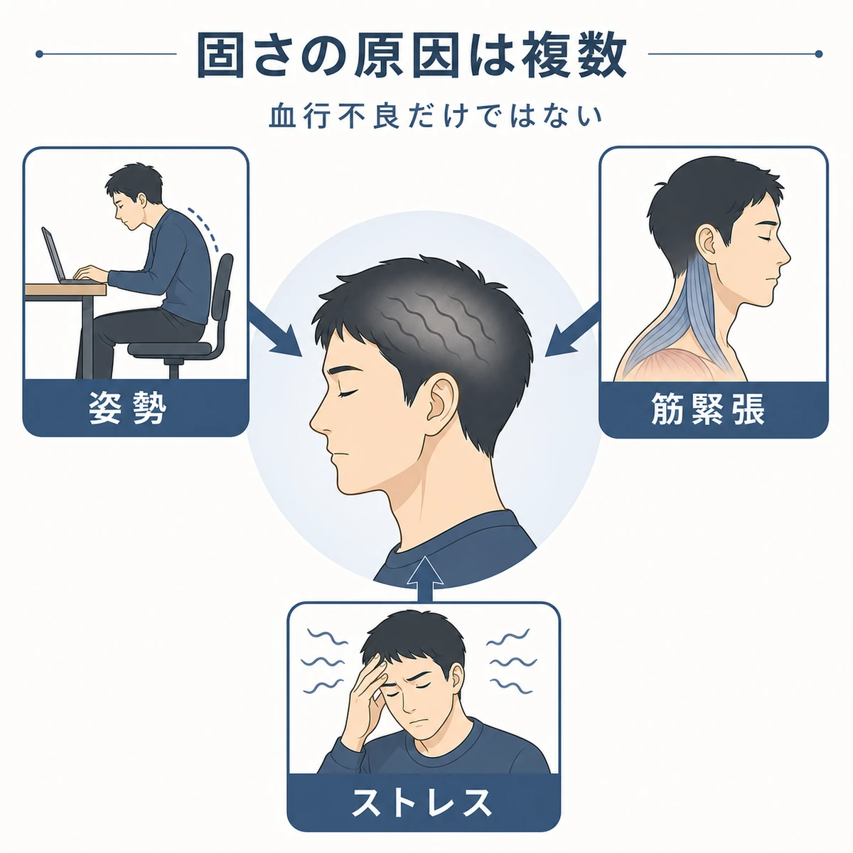 頭皮が固くなる複数の原因を頭部を中心に矢印でつないだ医療イラスト