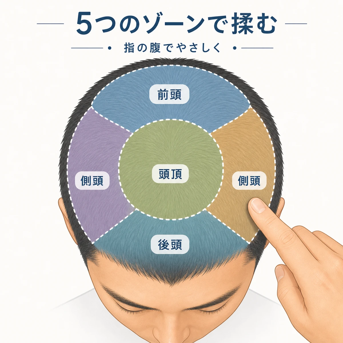 頭部を真上から見て5つのゾーンに色分けした頭皮マッサージの医療イラスト