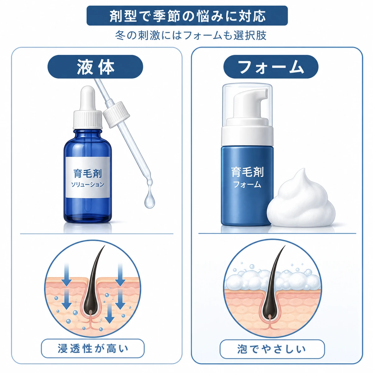 育毛剤の液体タイプとフォームタイプを並べて季節ごとの使い分けを表した医療イラスト