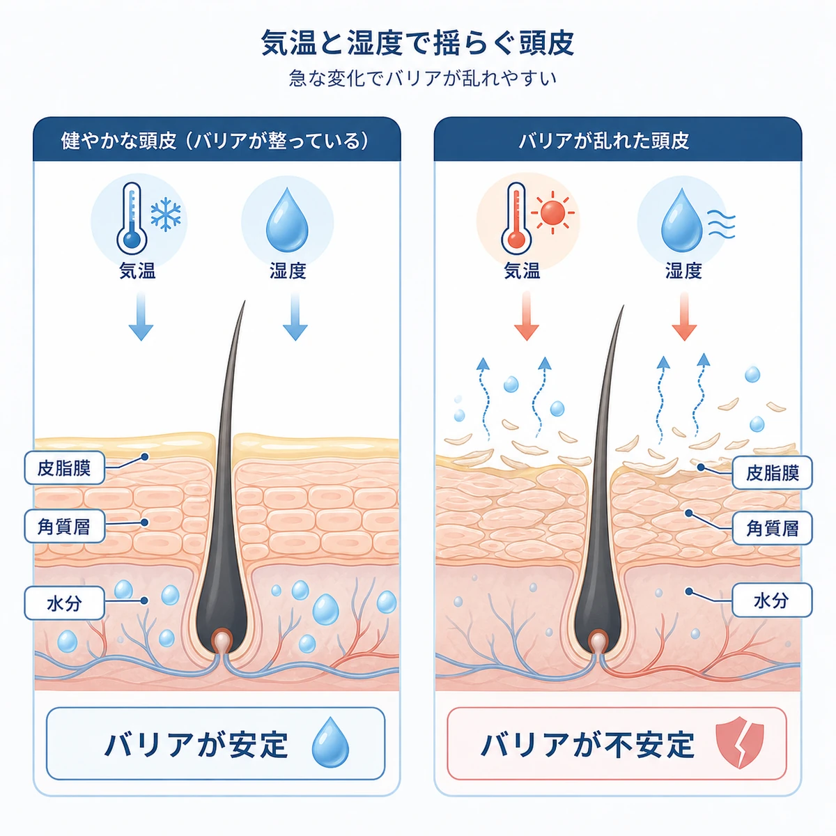気温と湿度の急変で頭皮のバリア機能が揺らぐ仕組みを健やかな状態と気になる状態で対比した医療イラスト