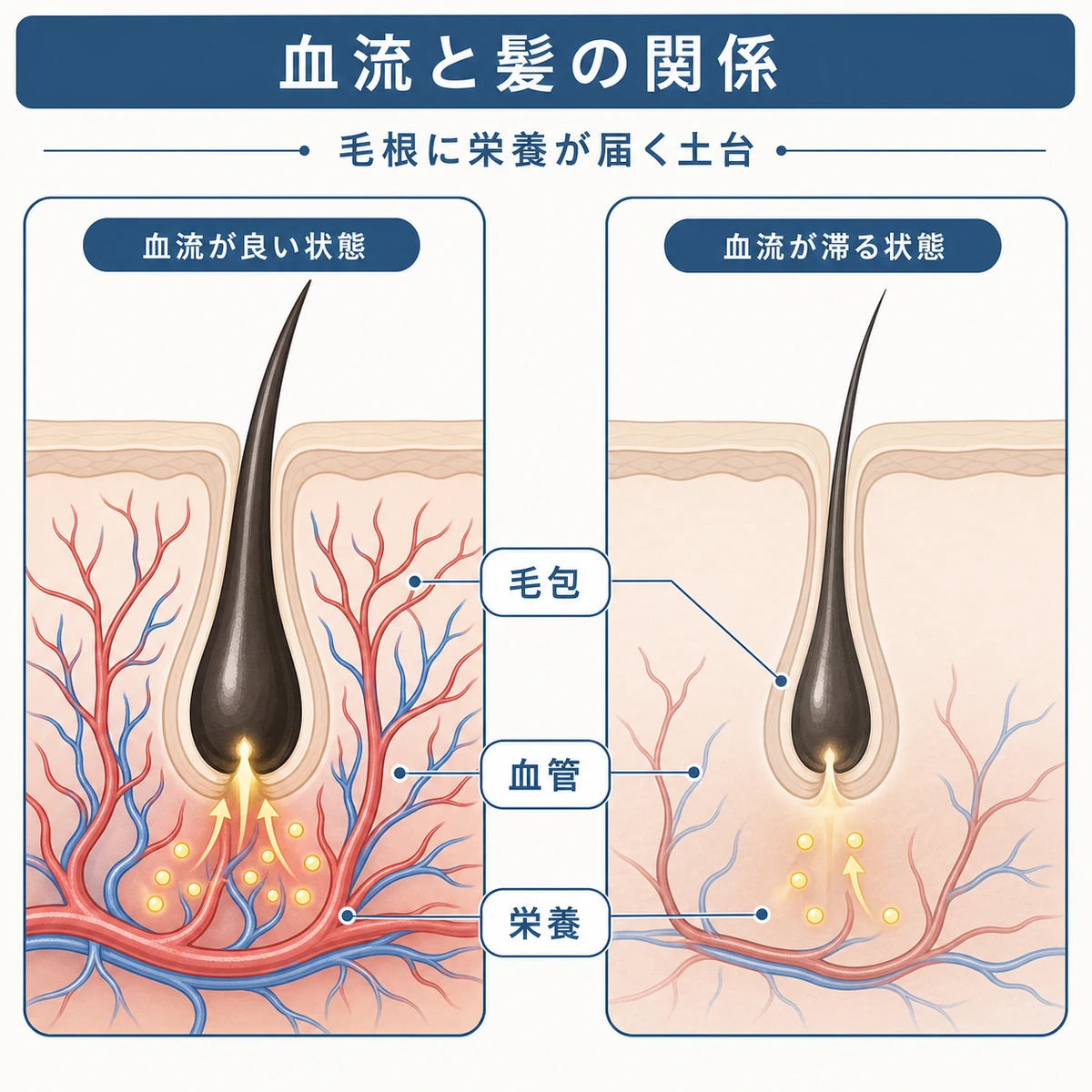 血管が集まる毛包と血流が少ない毛包を穏やかに対比し血流と髪の関係を表した医療イラスト