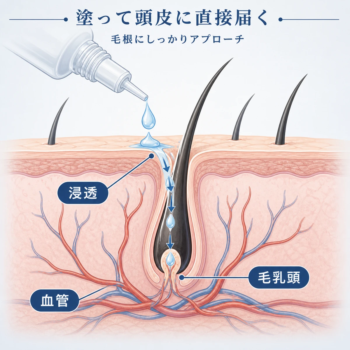 頭皮に塗ったセンブリエキスが毛穴から毛根へ浸透するしくみを表した頭皮の断面イラスト