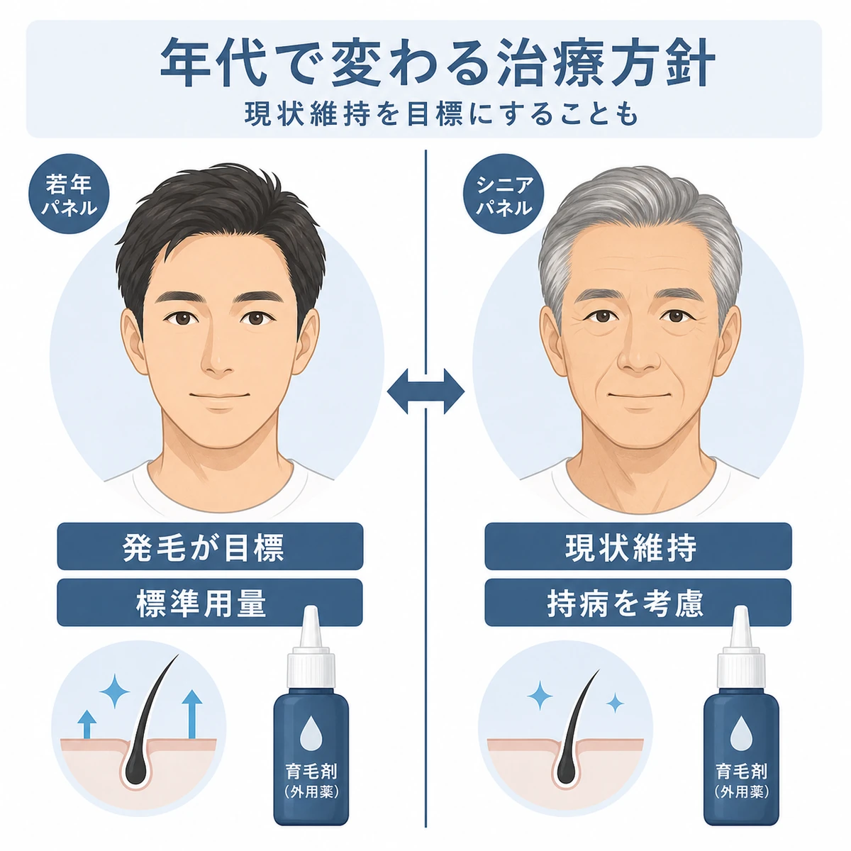 若年層とシニア世代でAGAの治療目標や薬の選び方が異なることを対比した医療イラスト