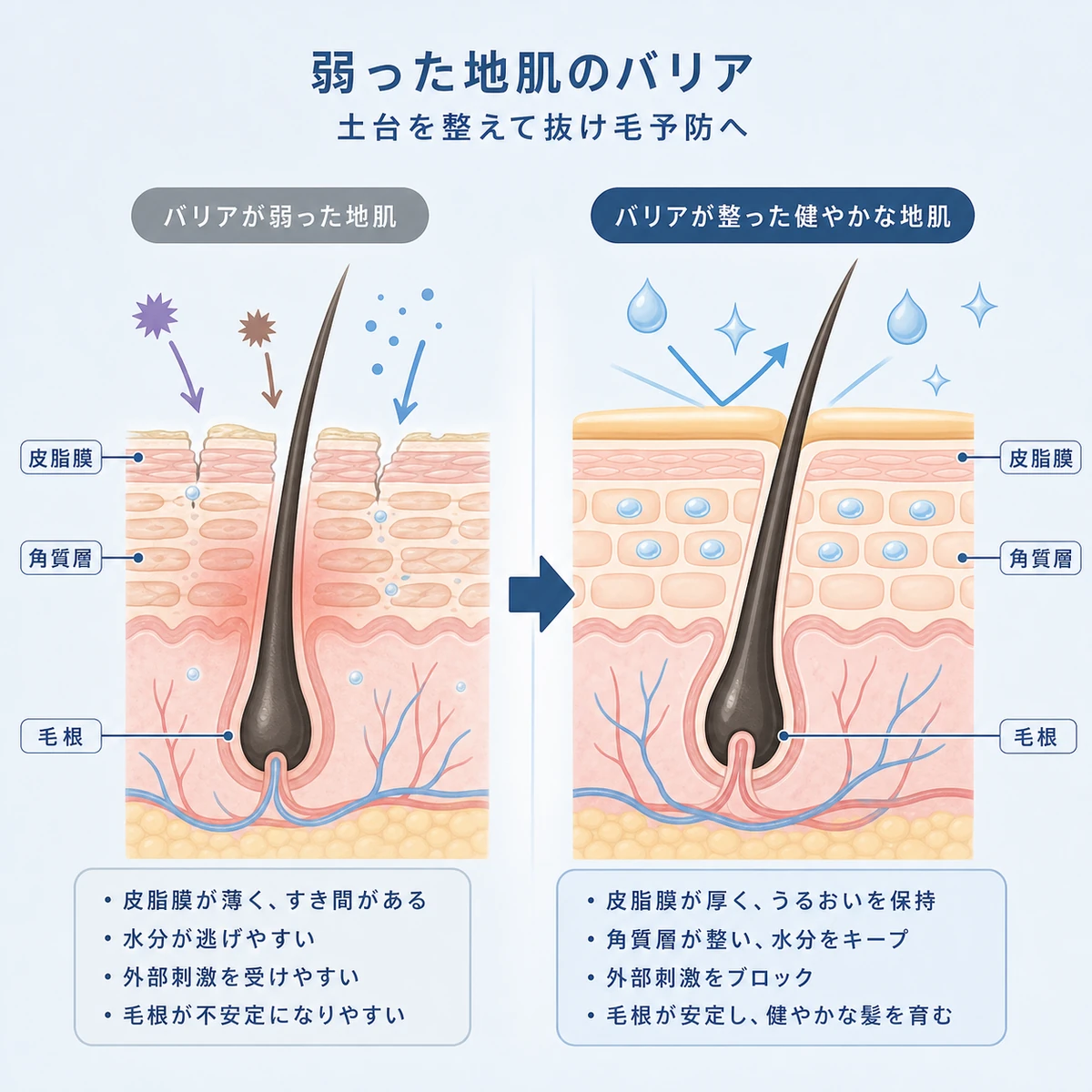 敏感肌の頭皮バリアが低下した状態と整った状態を対比した頭皮断面の医療イラスト