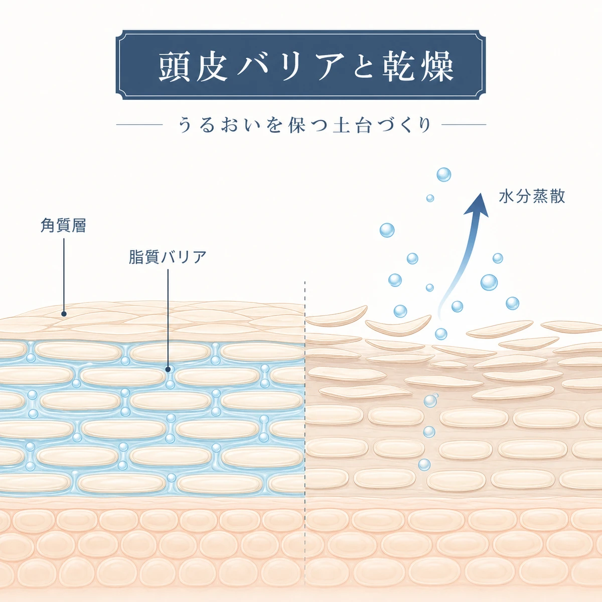 敏感肌の頭皮で角質層の脂質バリアが弱まり水分が逃げやすくなる仕組みを表した頭皮断面のイラスト
