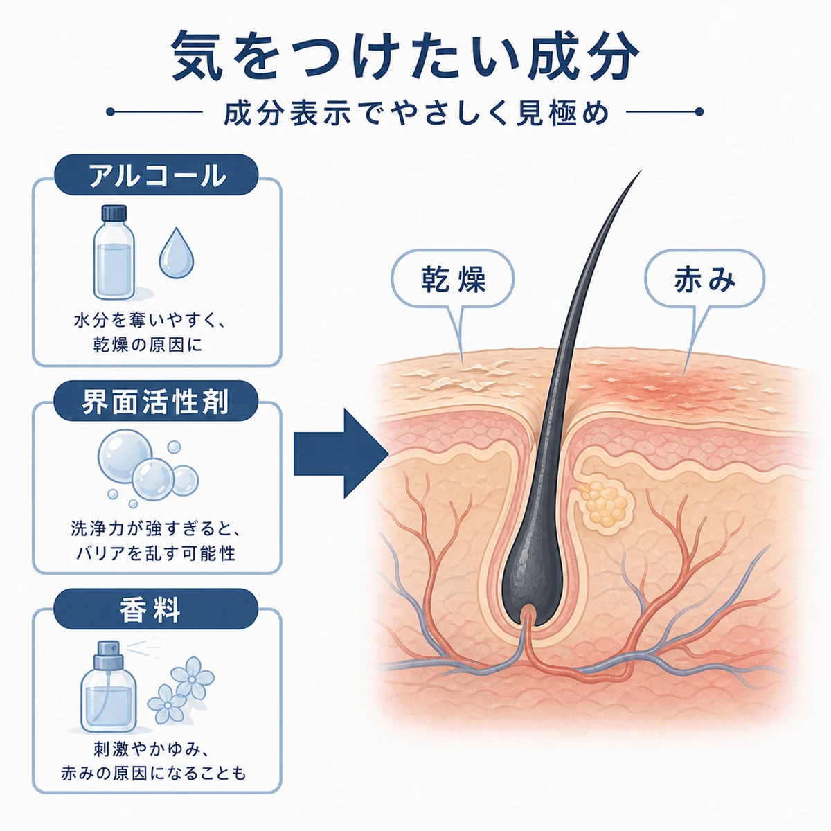 育毛剤で気をつけたい刺激成分と頭皮への影響を分類して描いた医療イラスト
