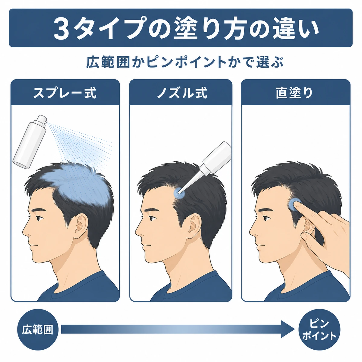 スプレー式・ノズル式・直塗りの塗布範囲の違いを3枚のパネルで比べた育毛イラスト
