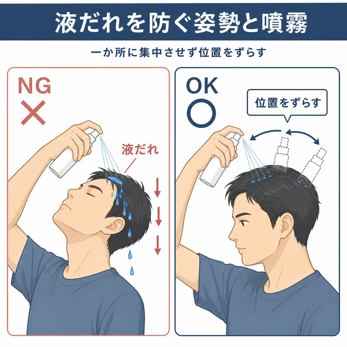 上向きで液だれするNG姿勢と前かがみで位置をずらすOK姿勢を対比した育毛イラスト